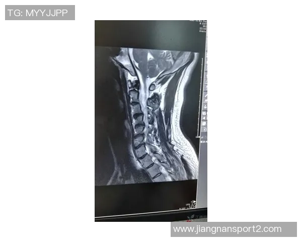 邓弗里斯今日将决定手术与否国米关注帕莱斯特拉和库菲动态